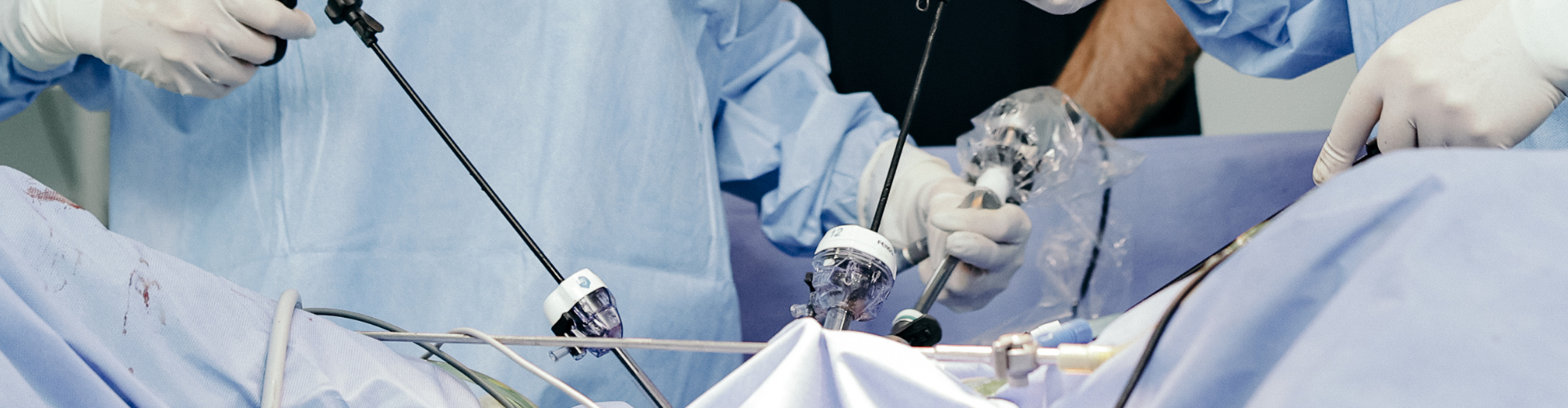 ზოგადი და მინიინვაზიური ქირურგია