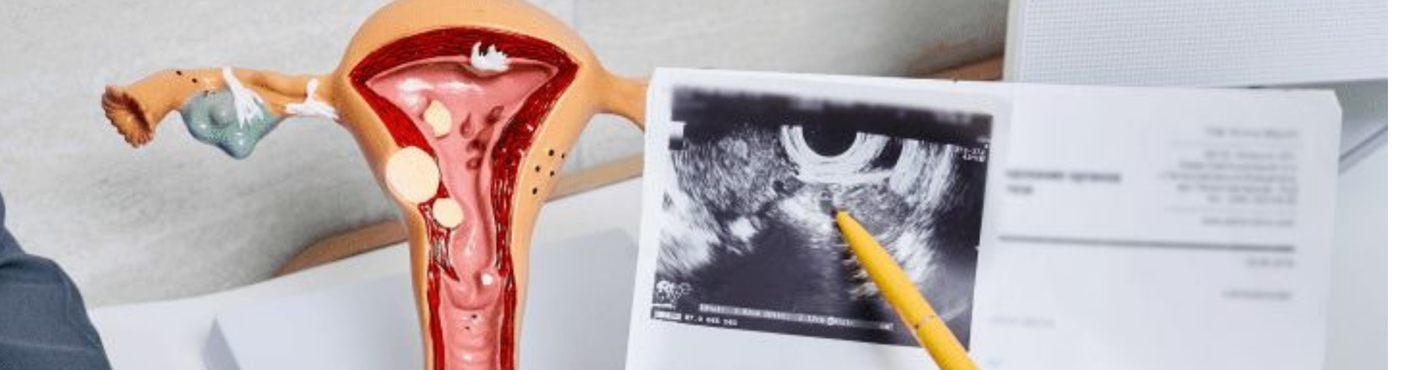 ქირურგიული გინეკოლოგია