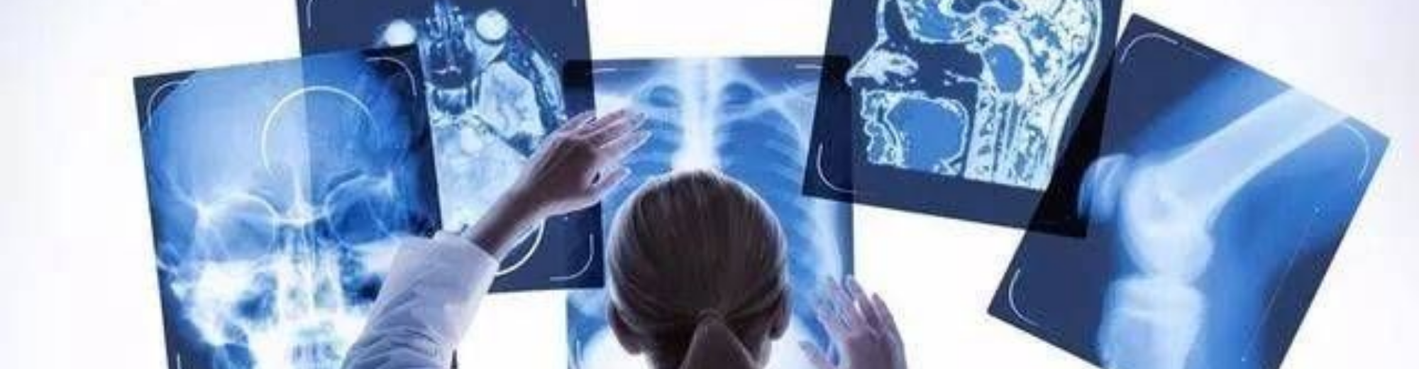 რენტგენოდიაგნოსტიკა